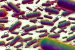 E.coli Outbreak new breaking, E.coli Outbreak breaking updates, all about e coli outbreak in the united kingdom, Scotland