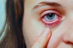 Conjunctivitis cure, Conjunctivitis videos, special measures to prevent conjunctivitis, Body organs