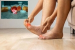 Gout Drugs latest update, Gout Drugs, gout drugs may cut the risk of heart attack, United states Gout Drugs latest update, Gout Drugs, gout drugs may cut the risk of heart attack, United states