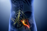Sciatica nerve disorder, Sciatica nerve, help yourself on sciatica, Natural remedies