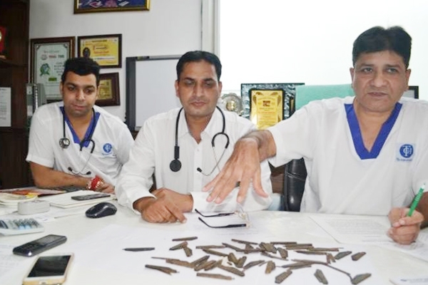 Doctors remove 40 knives from man's stomach!